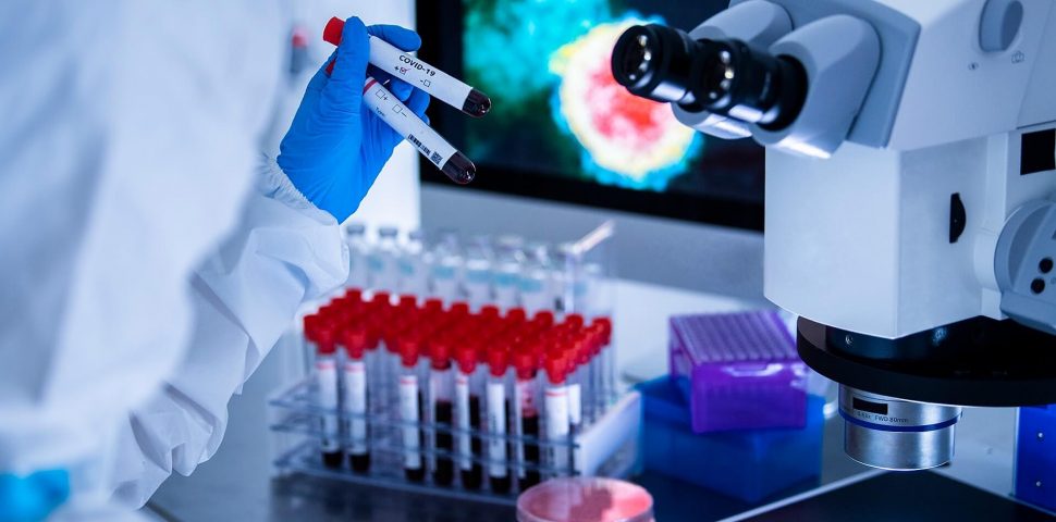 Teste de Anticorpos Neutralizantes