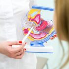 Como identificar e prevenir o câncer de colo de útero