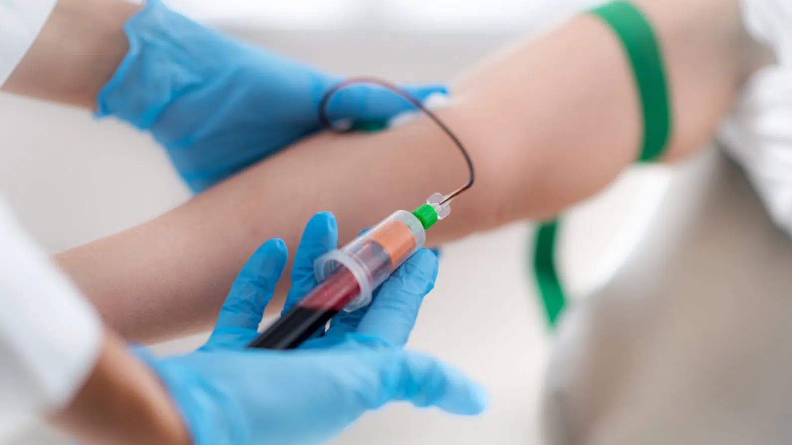 O que é colesterol? O que você precisa saber e por que fazer o exame?