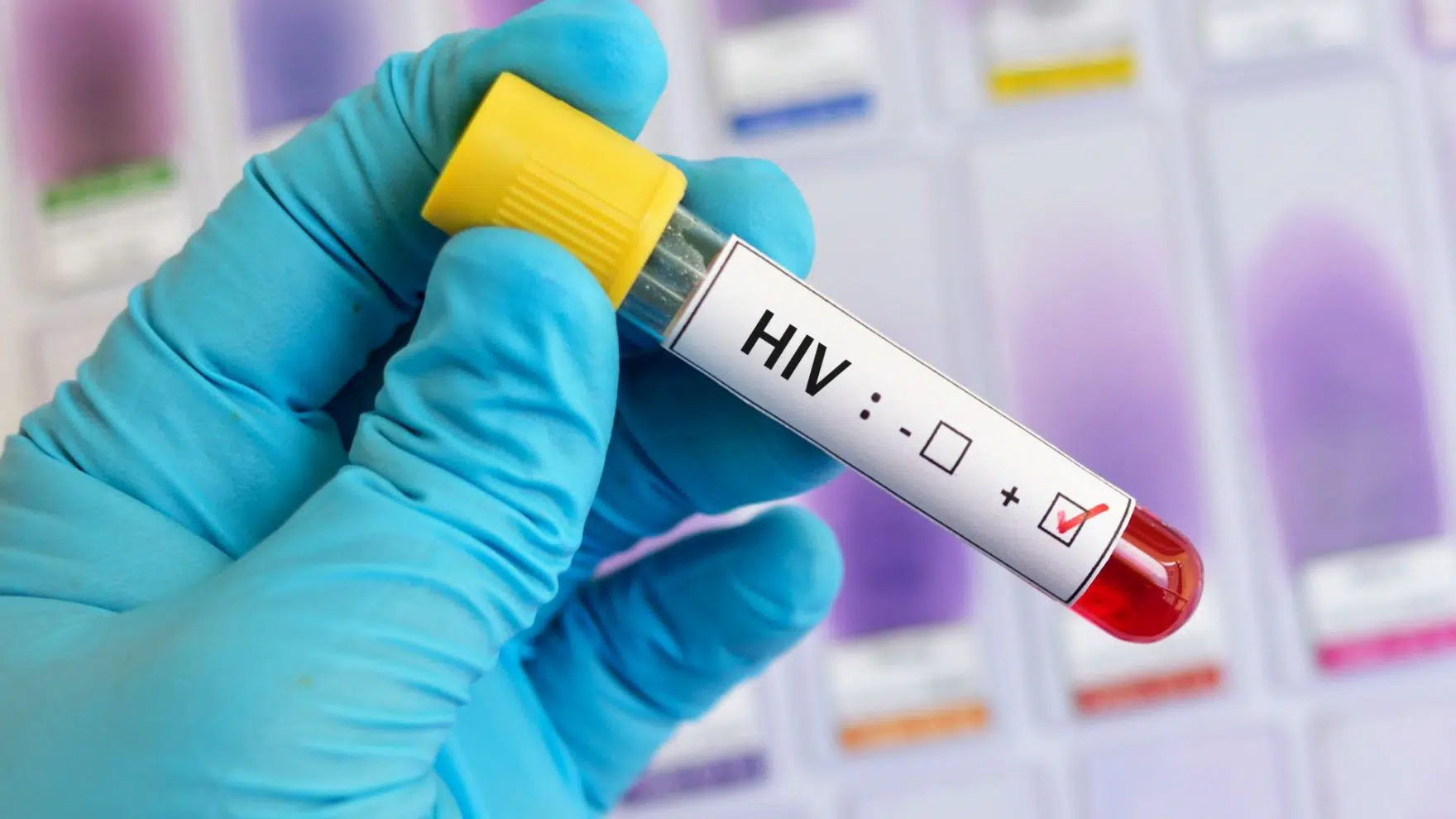 Como é viver com HIV atualmente?