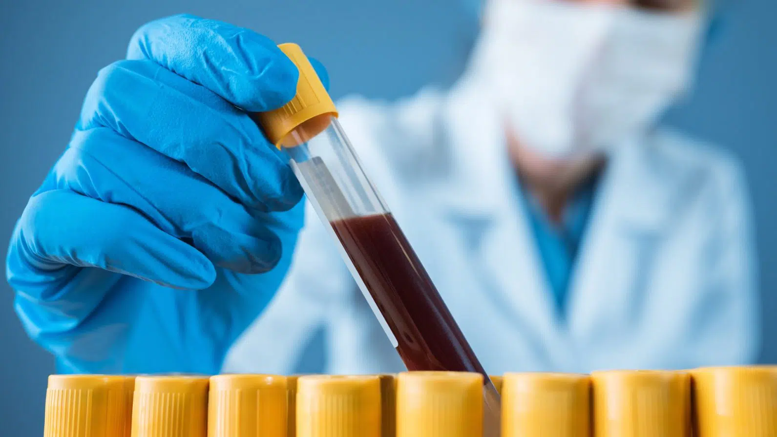 Exames hematológicos: você sabe o que eles avaliam e quais são os principais?