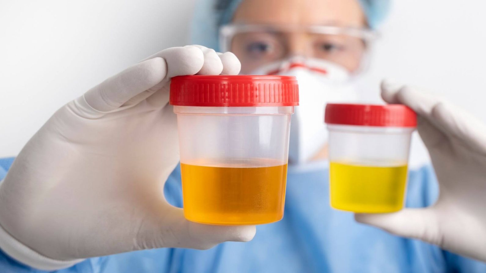 Avaliação clínico-laboratorial das doenças renais