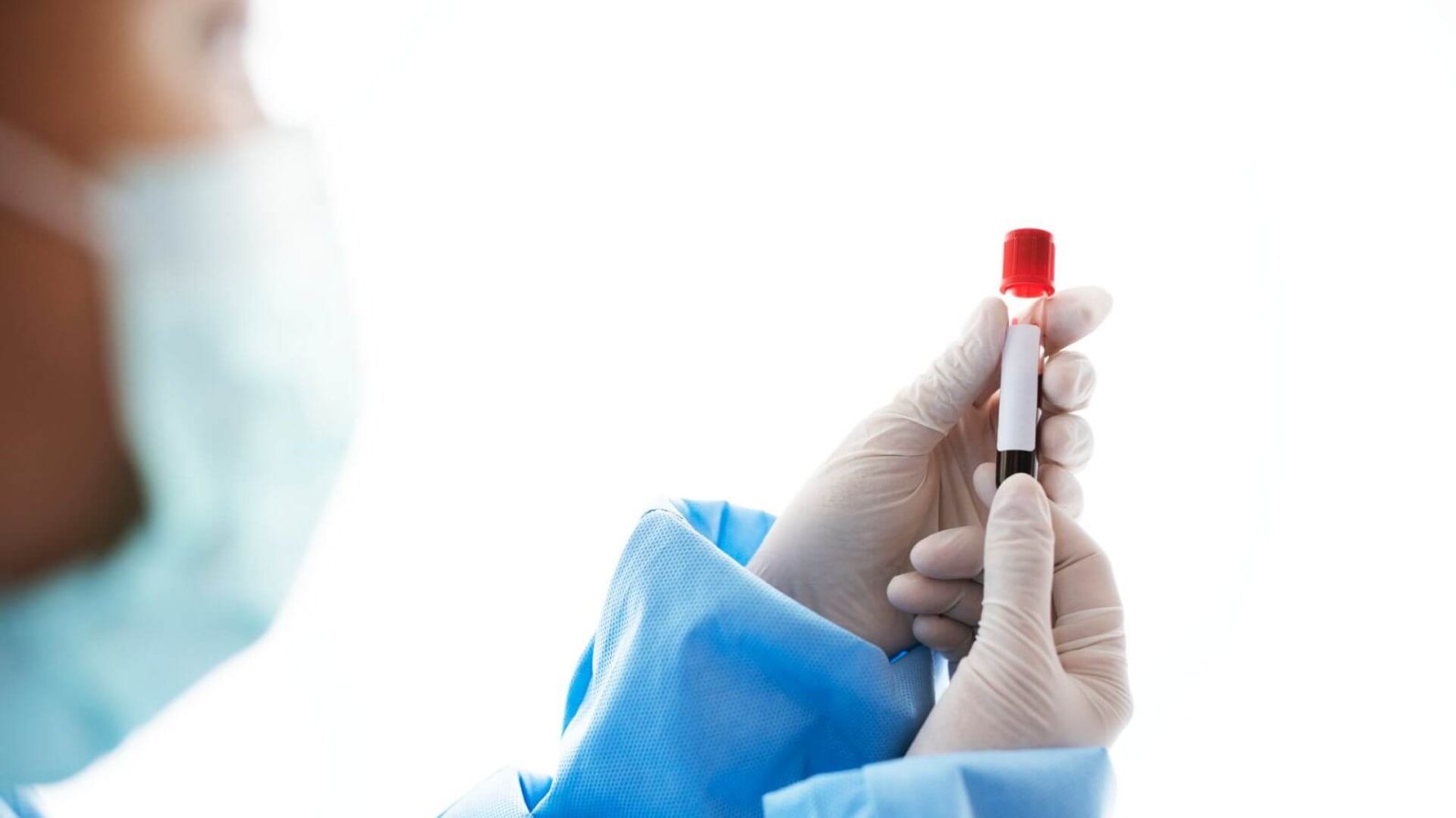 Avaliação laboratorial da hemostasia na prática médica