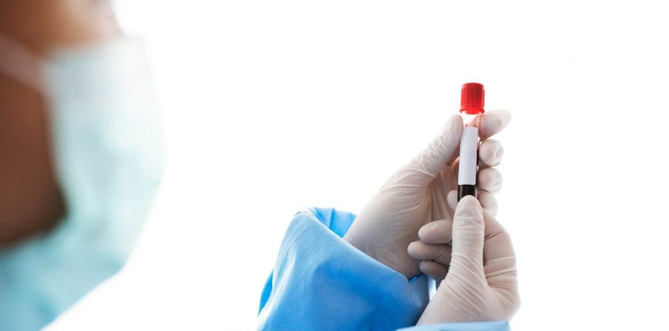 Como é feita a avaliação laboratorial da hemostasia?