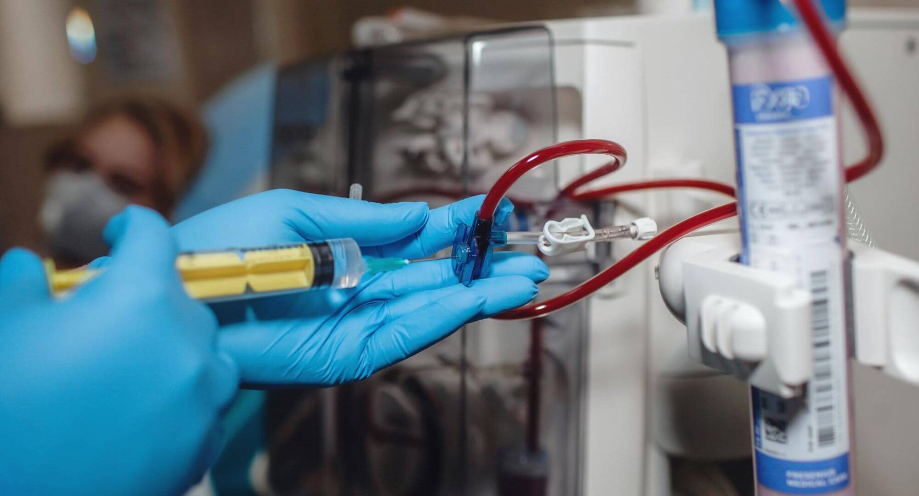 Insuficiência renal crônica: o que é e quais os sintomas