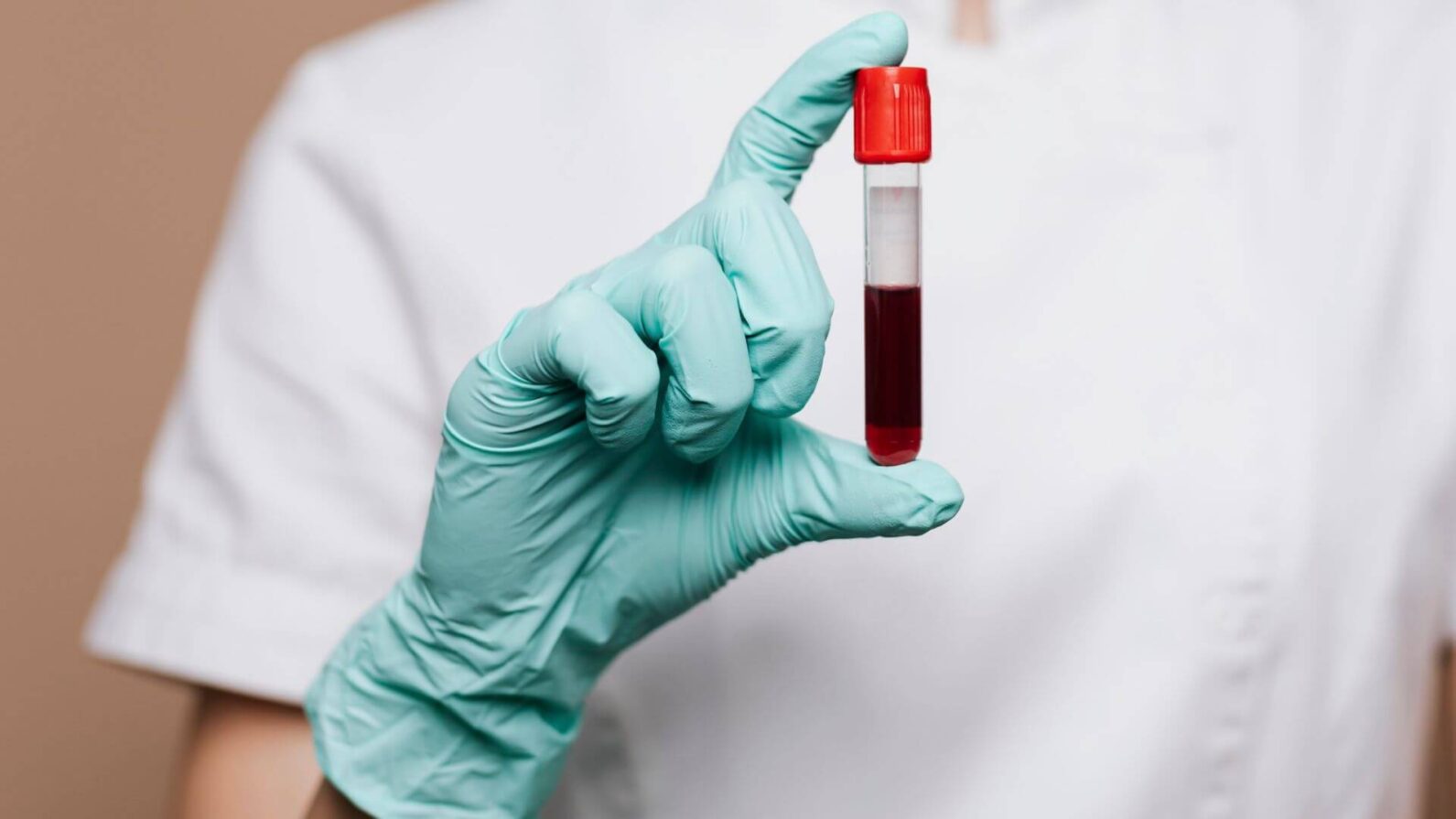 O que é a talassemia? Saiba mais sobre essa doença