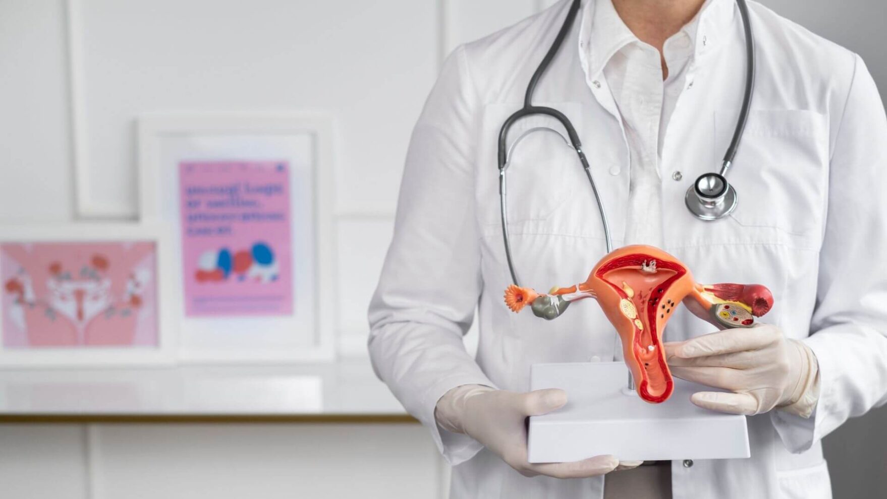 Conheça a utilidade do diagnóstico molecular na vaginose bacteriana