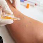 Como identificar uma alergia alimentar?