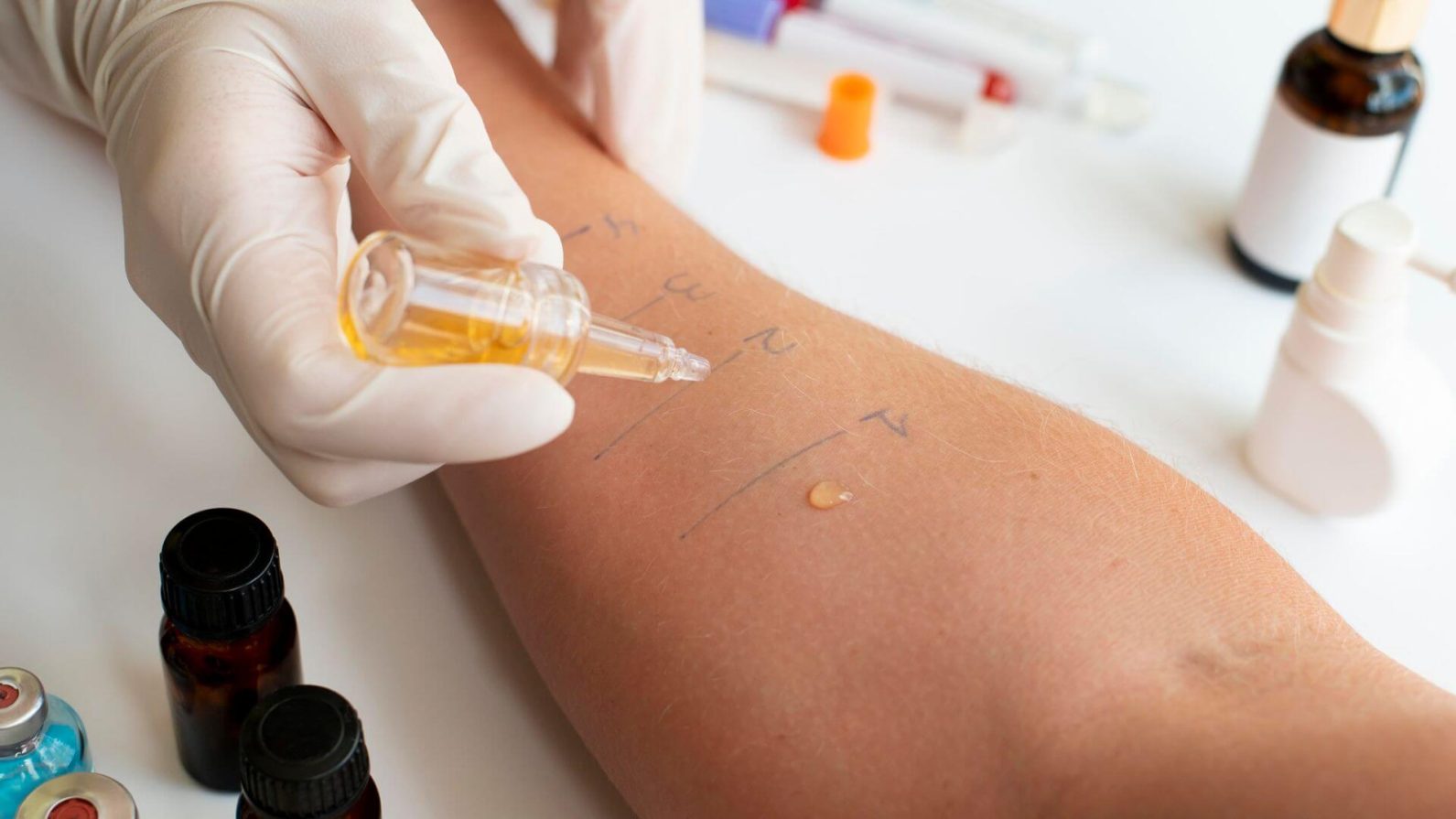 Entenda o que é alergia alimentar e como é feito o diagnóstico